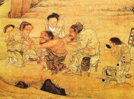 Acupuncture: ancient Chinese invention